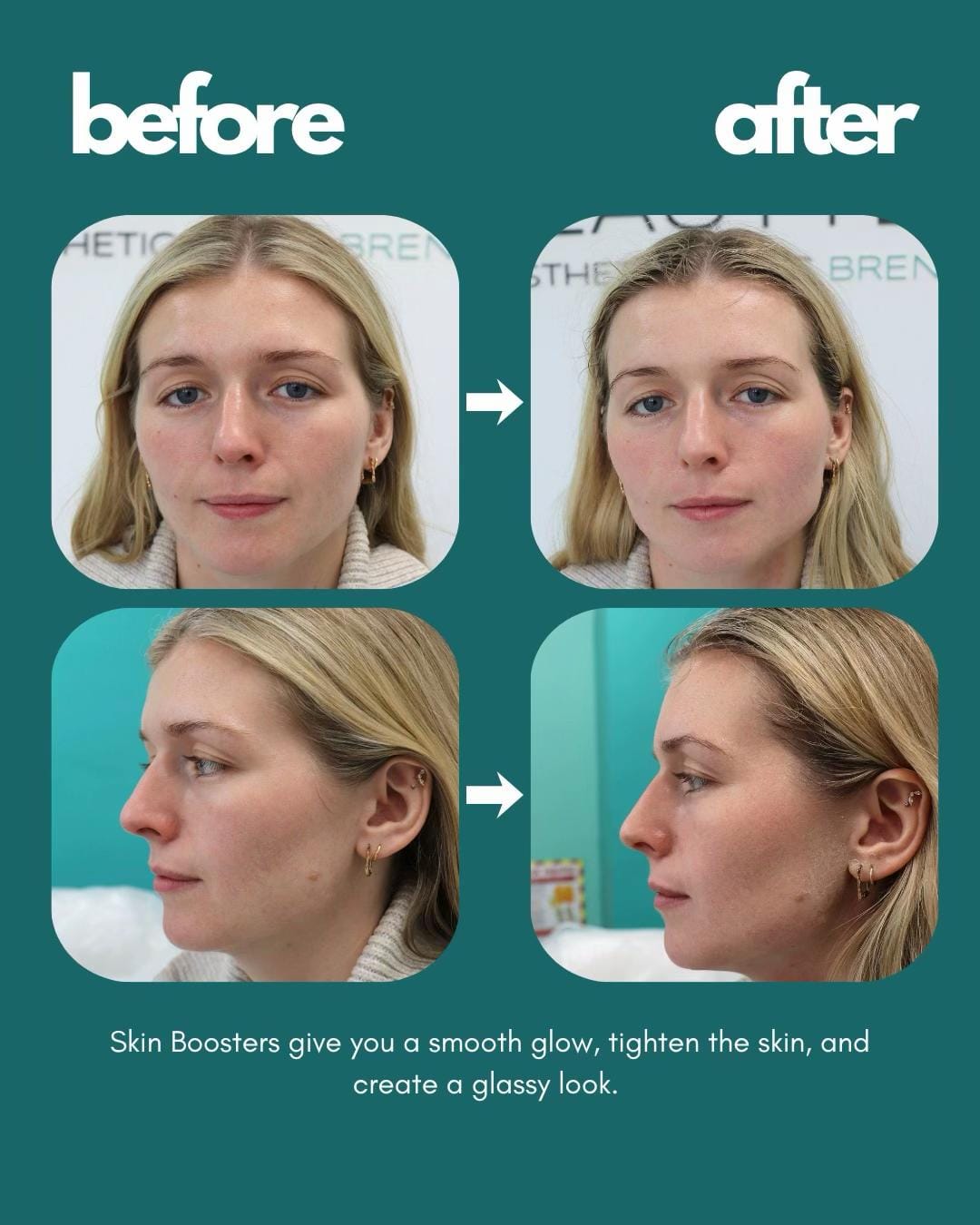 Post 4 by 65beauty on TikTok (video)