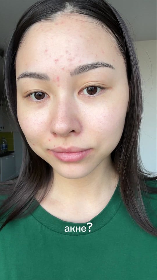 Post 3 by Bota on TikTok (video)
