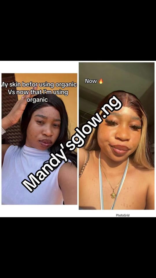Post 8 by mandysglow.ng on TikTok (video)