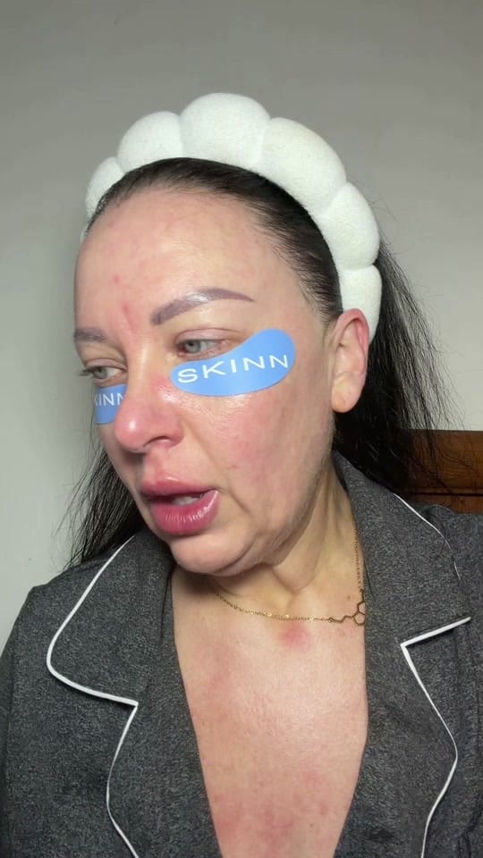 Post 6 by Christie MSN-RN, Aesthetics on TikTok (video)