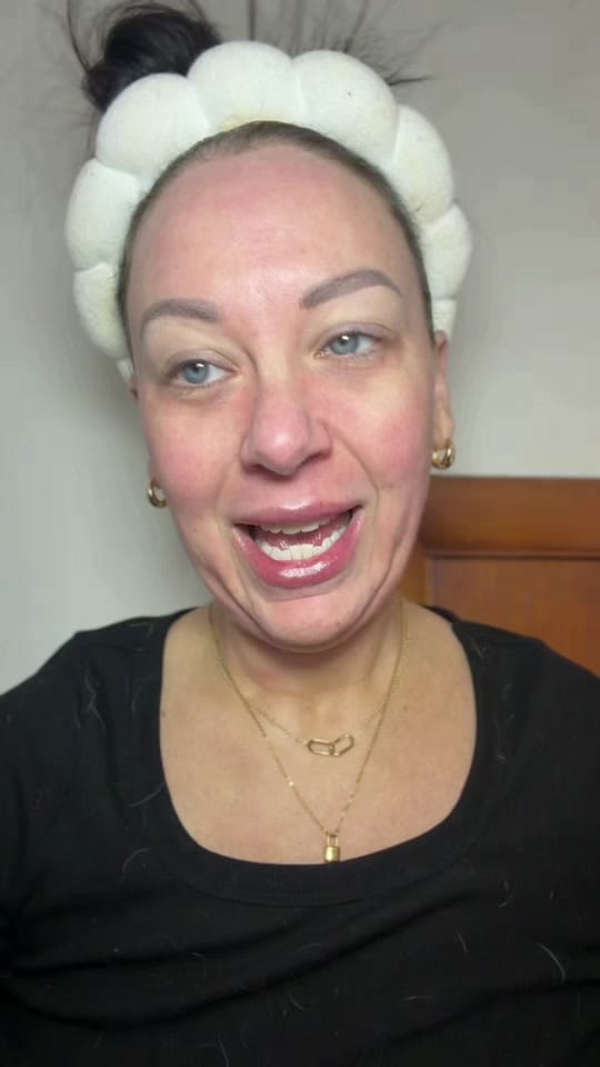 Post 2 by Christie MSN-RN, Aesthetics on TikTok (video)