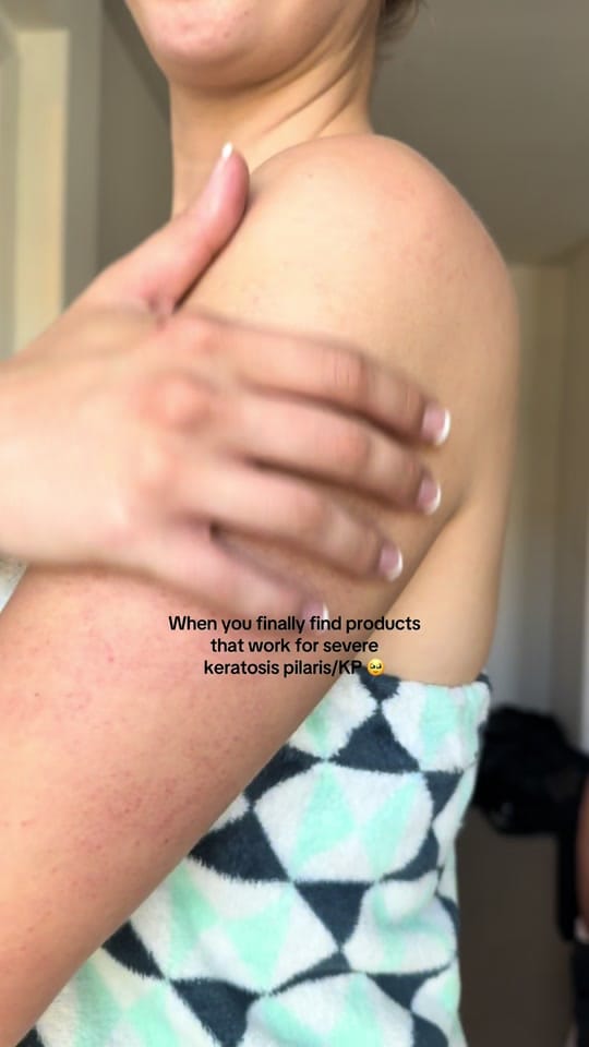 Post 10 by NEAVE on TikTok (video)