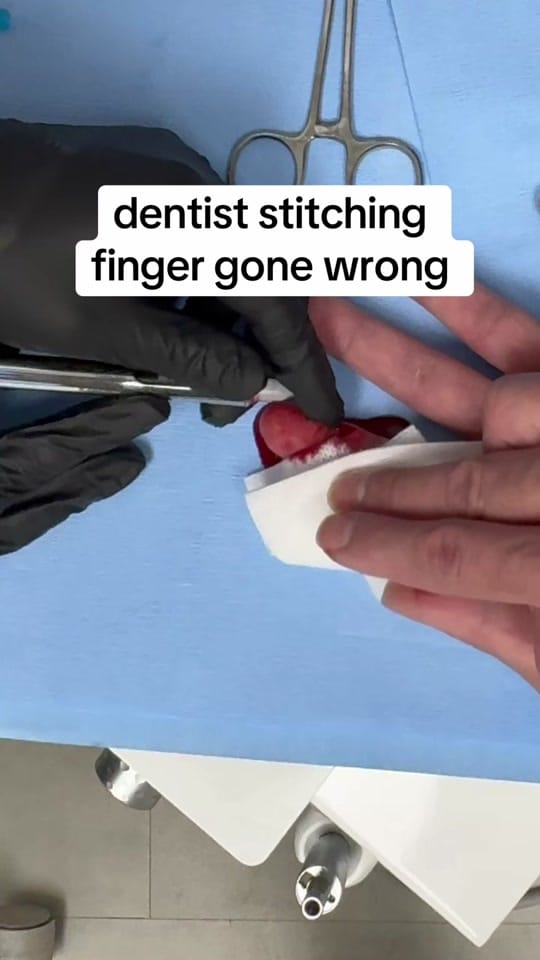 Post 5 by Dr. Gino, DDS 🦷 on TikTok (video)