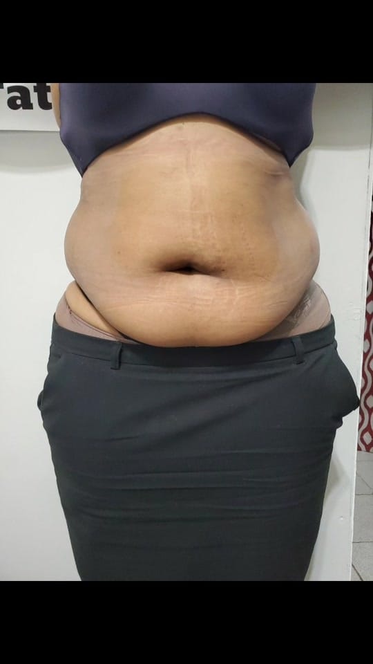 Post 10 by Glits & Glamor Body Contouring on TikTok (video)