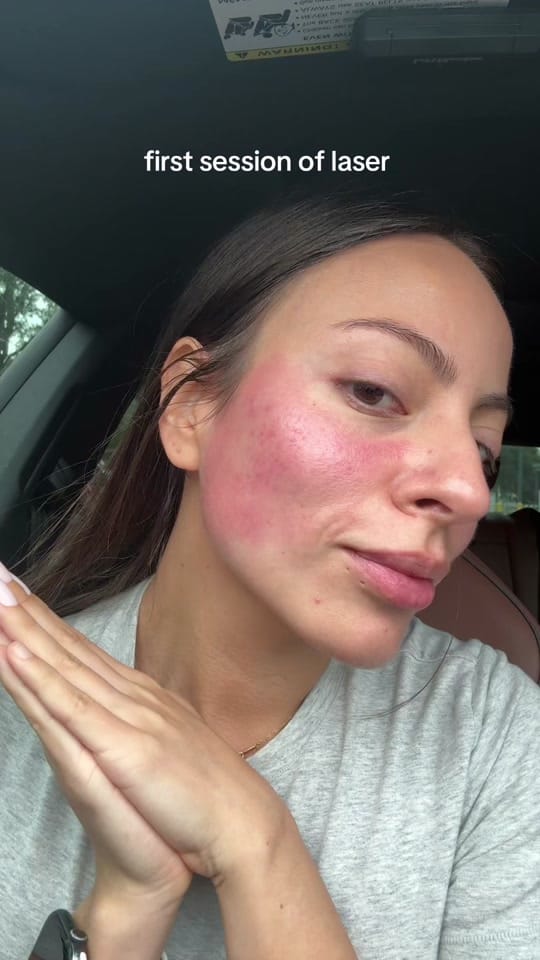 Post 1 by esme on TikTok (video)