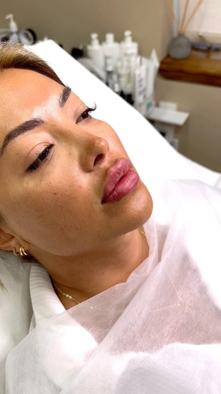 Post 9 by Lips • Botox | Brooklyn • New York • Miami on Instagram (video)