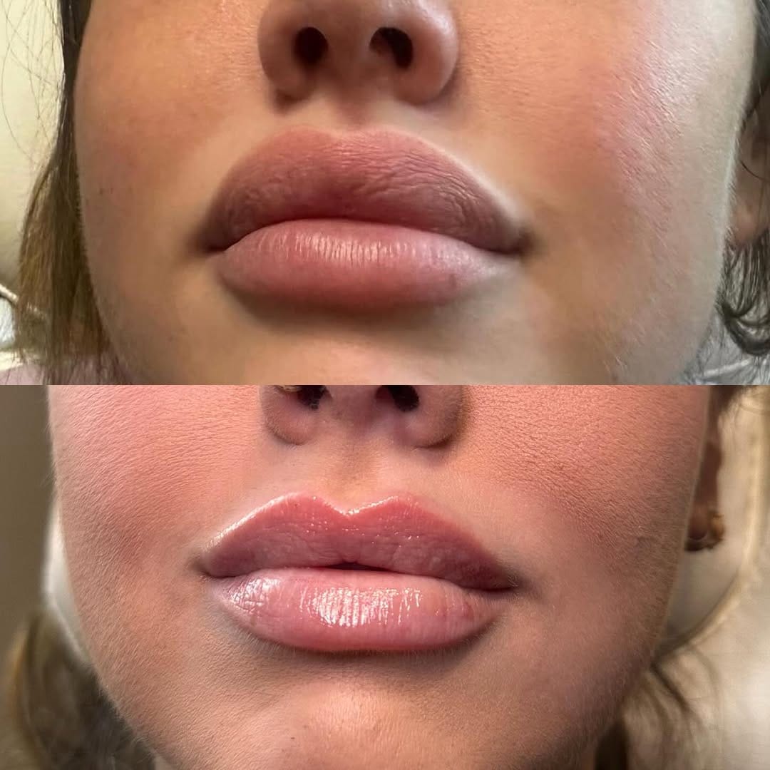 Post 8 by ℂ𝕒𝕣𝕝𝕪, 𝔸𝕖𝕤𝕥𝕙𝕖𝕥𝕚𝕔 ℝℕ on Instagram (carousel)