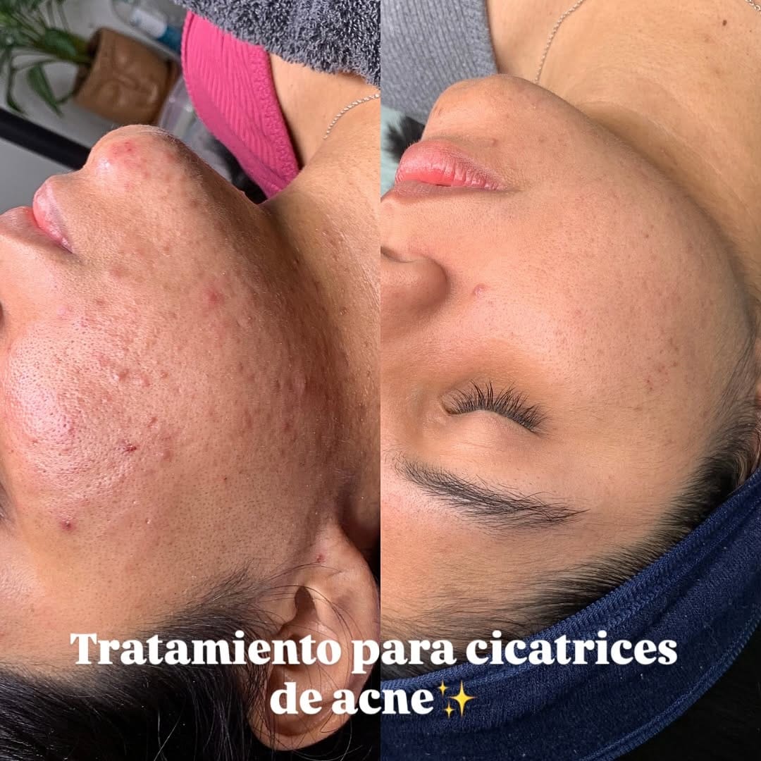 Post 9 by Naye Diaz | Piel & Salud Capilar on Instagram (carousel)