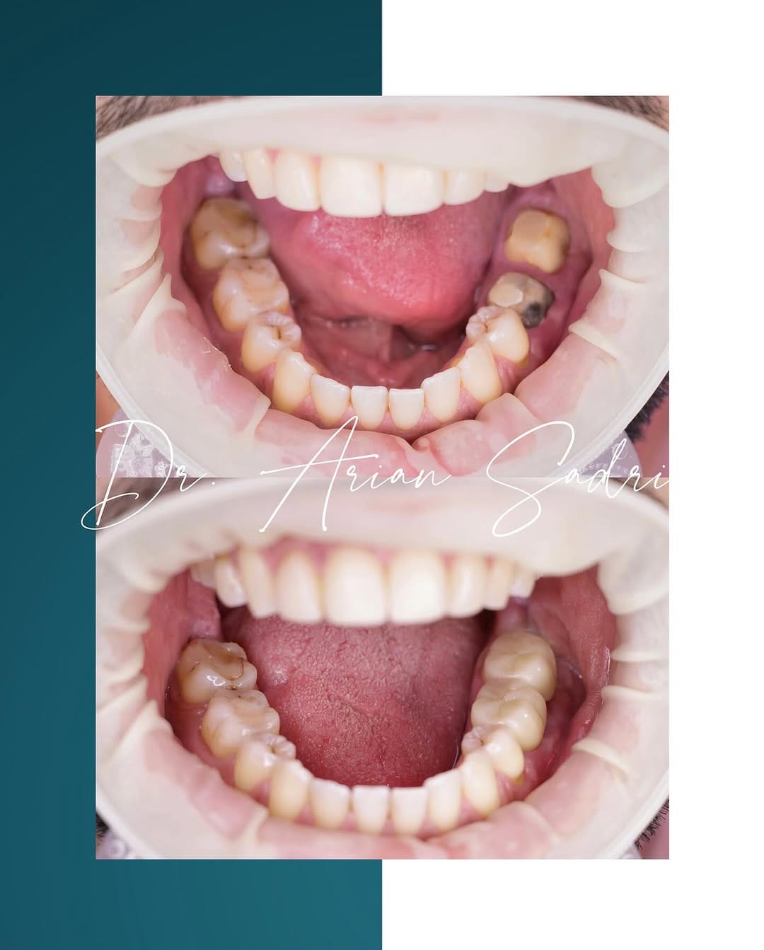 Post 1 by Dr. Arian Sadri on Instagram (image)