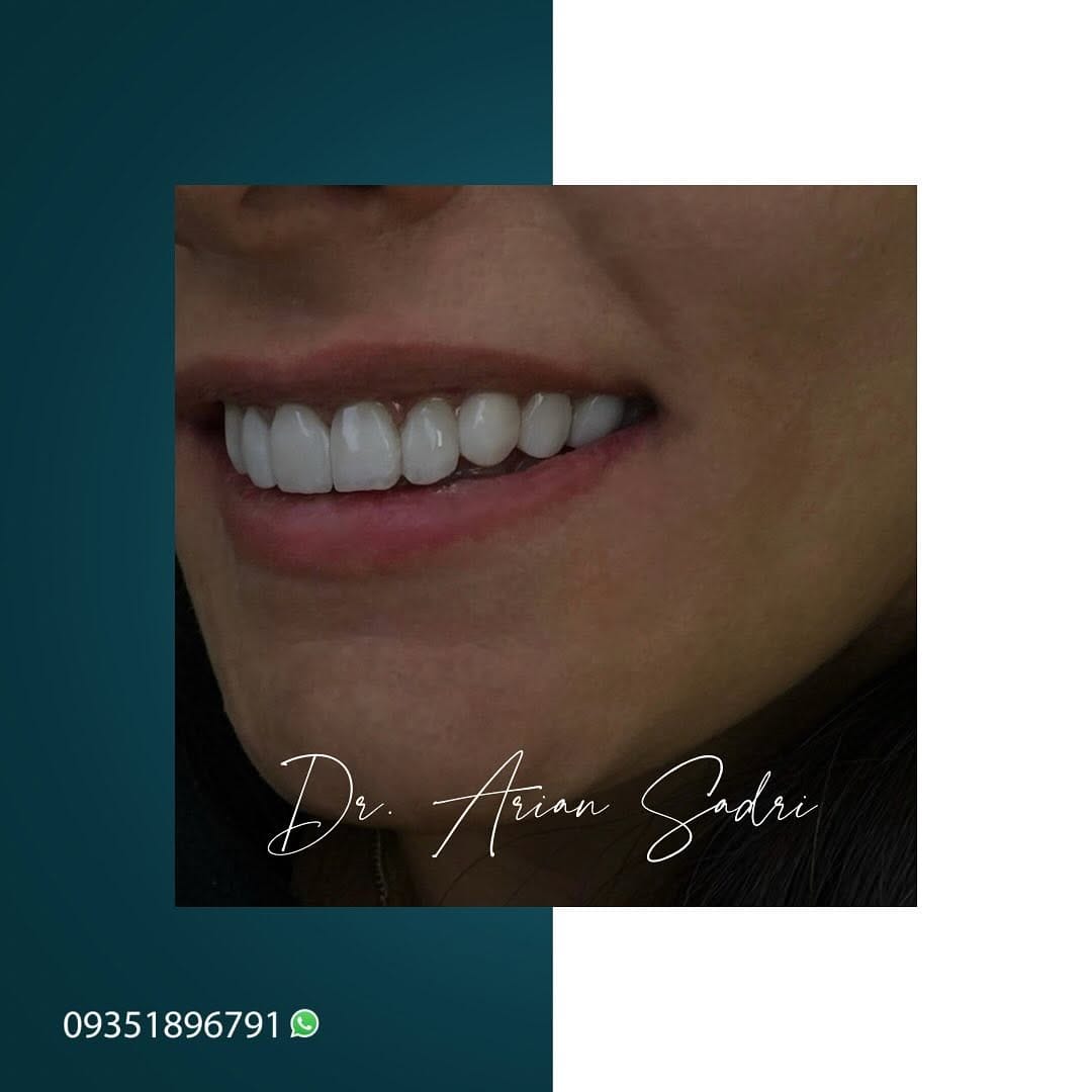 Post 10 by Dr. Arian Sadri on Instagram (image)