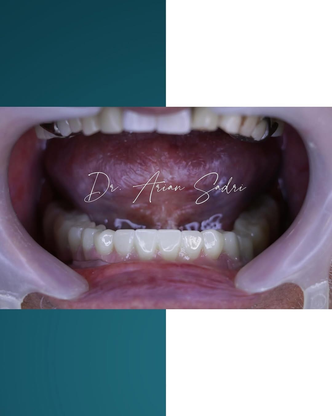 Post 4 by Dr. Arian Sadri on Instagram (carousel)