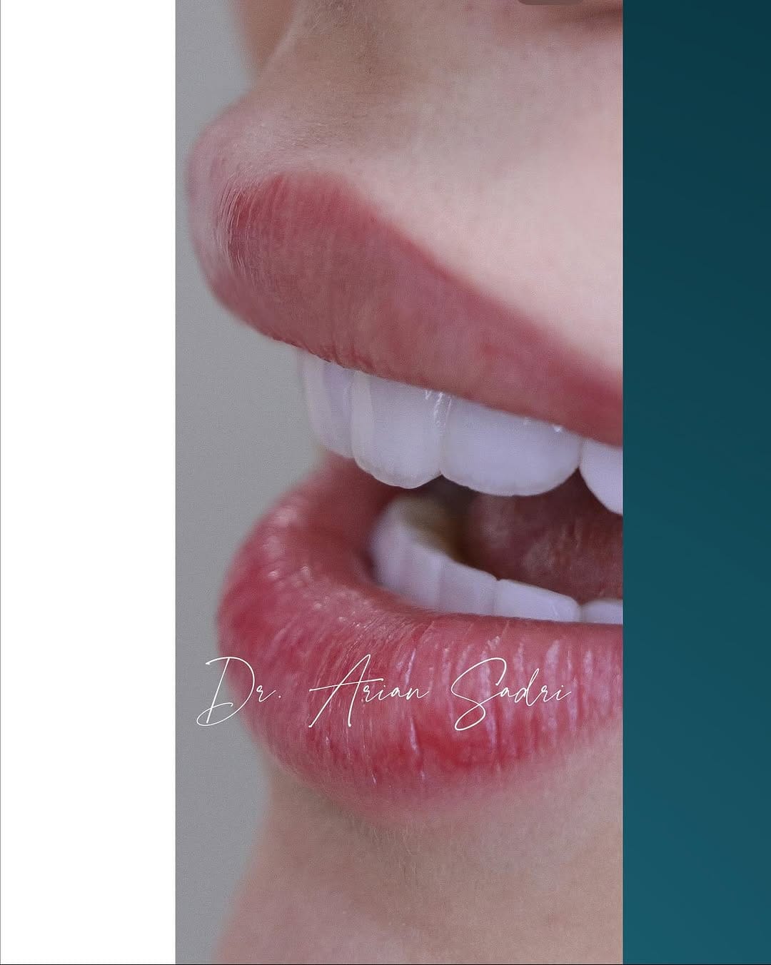 Post 9 by Dr. Arian Sadri on Instagram (image)