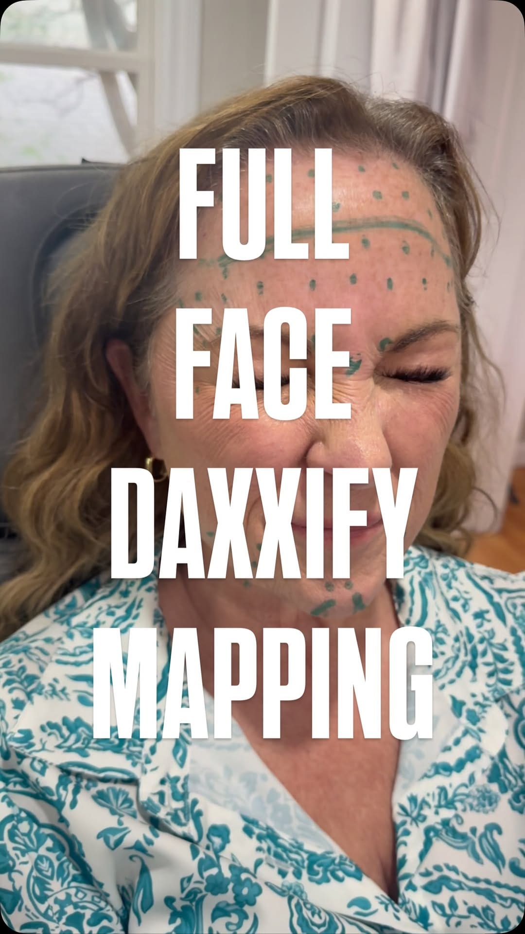 Post 2 by Shelby G.  BSN, RN, CANS BISHOP ARTS| DALLAS|SOUTHLAKE INJECTOR on Instagram (video)