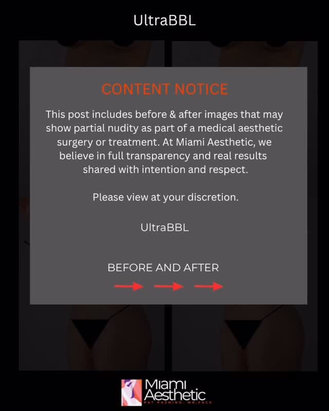 Post 10 by Miami Aesthetic on Instagram (video)