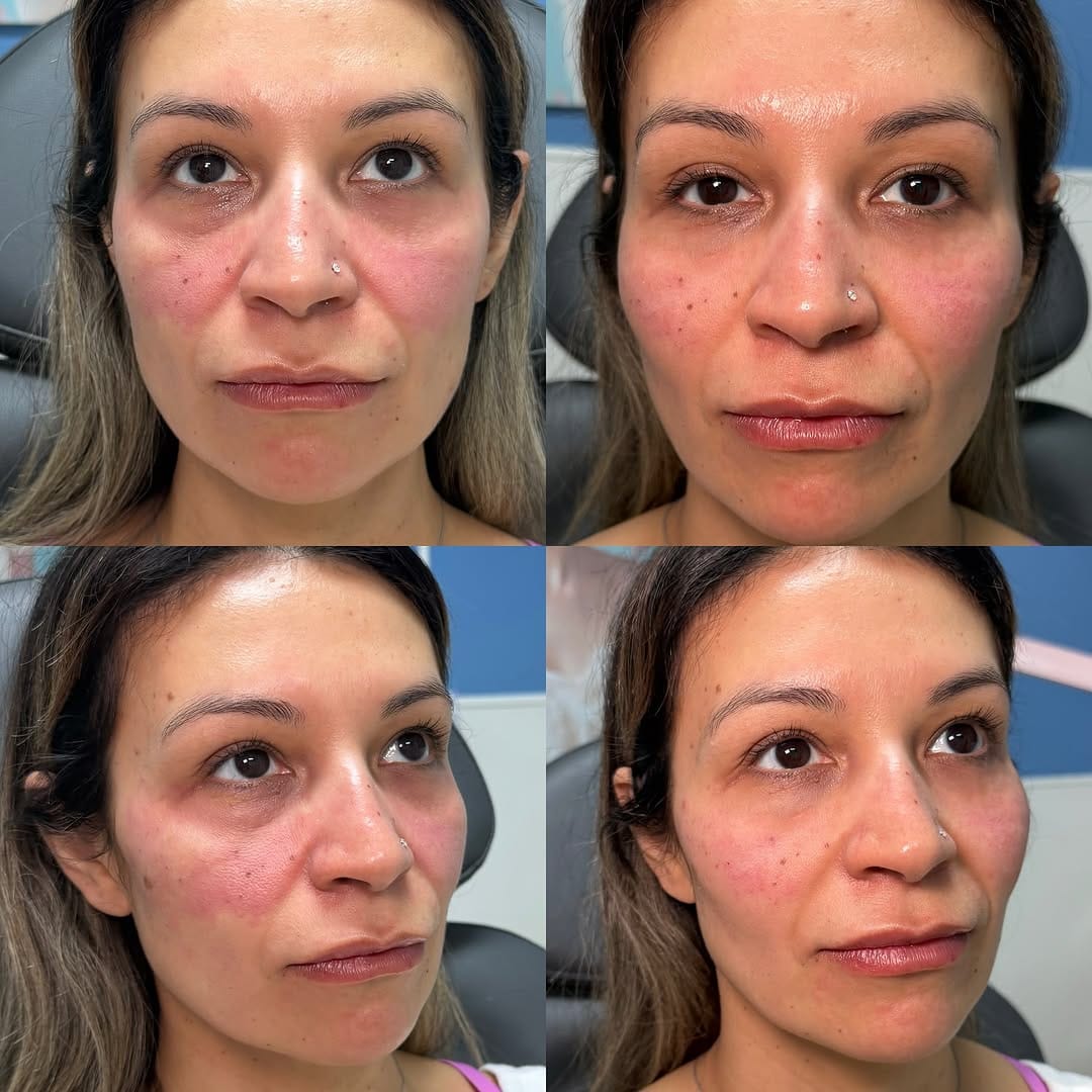 Post 10 by Ivy En Rose | Medical Spa on Instagram (carousel)