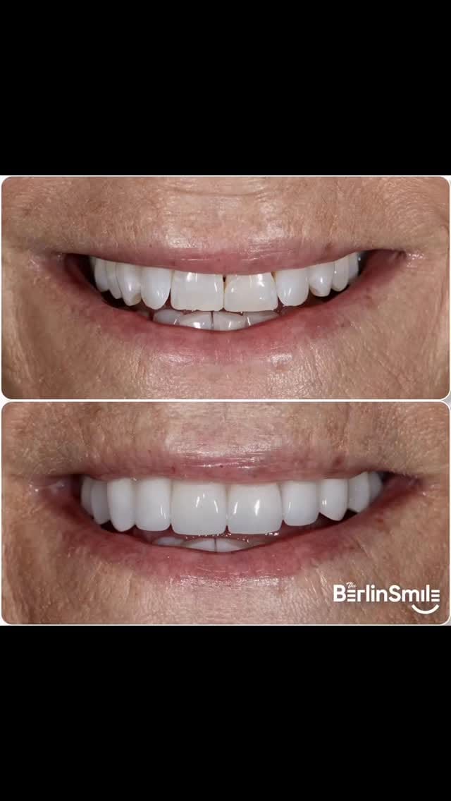 Post 8 by Dr. Marvin Berlin on Instagram (video)