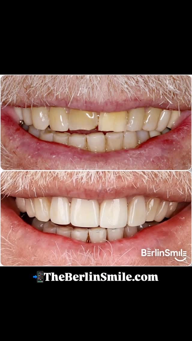 Post 2 by Dr. Marvin Berlin on Instagram (video)