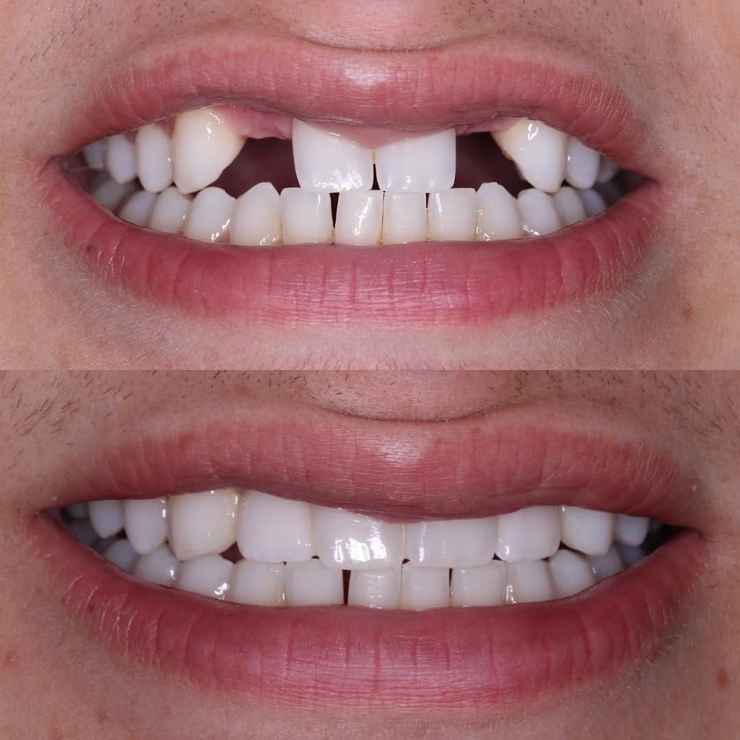 Post 10 by Dr. Joseph Cipriano DDS on Instagram (image)