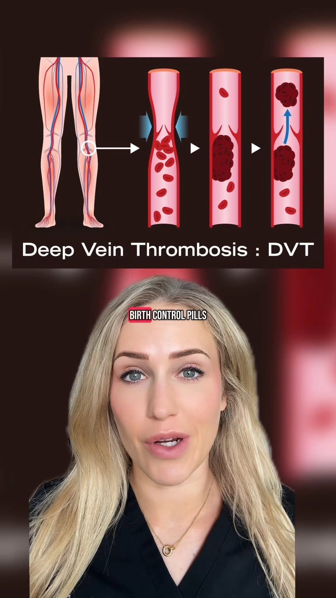 Post 8 by Dr. Dana Figura, DPM on Instagram (video)
