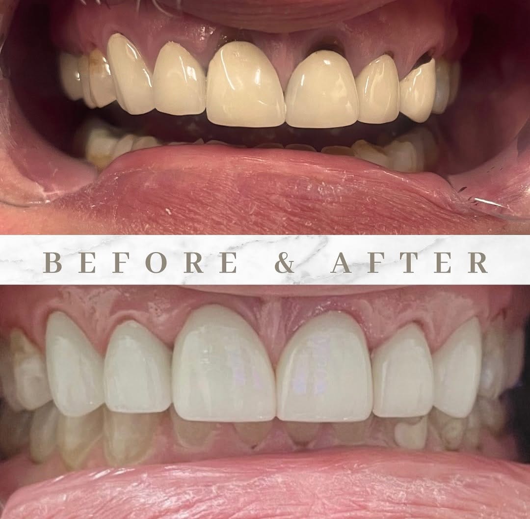 Post 8 by Dr. Salina Arafat on Instagram (image)
