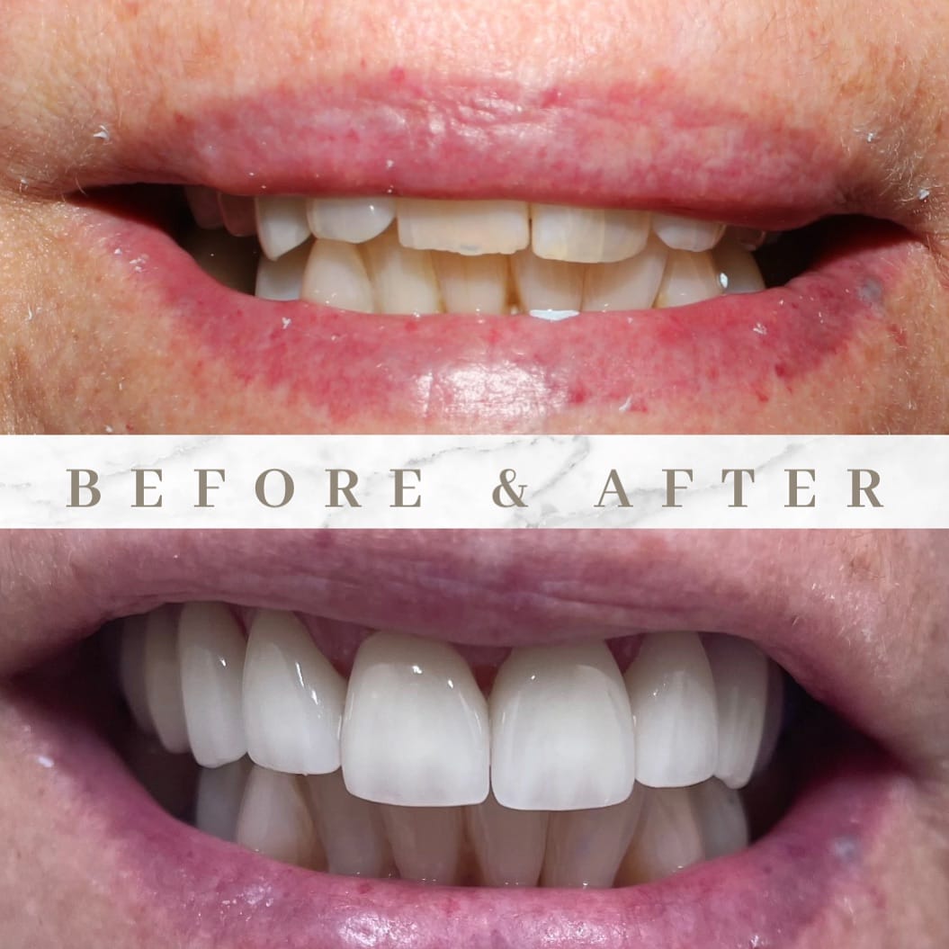 Post 10 by Dr. Salina Arafat on Instagram (image)