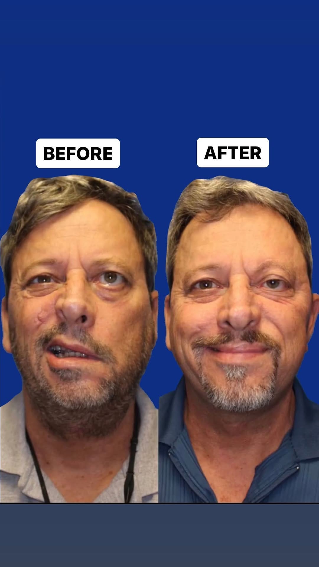 Post 10 by Dr. Matthew Tamplen on Instagram (video)