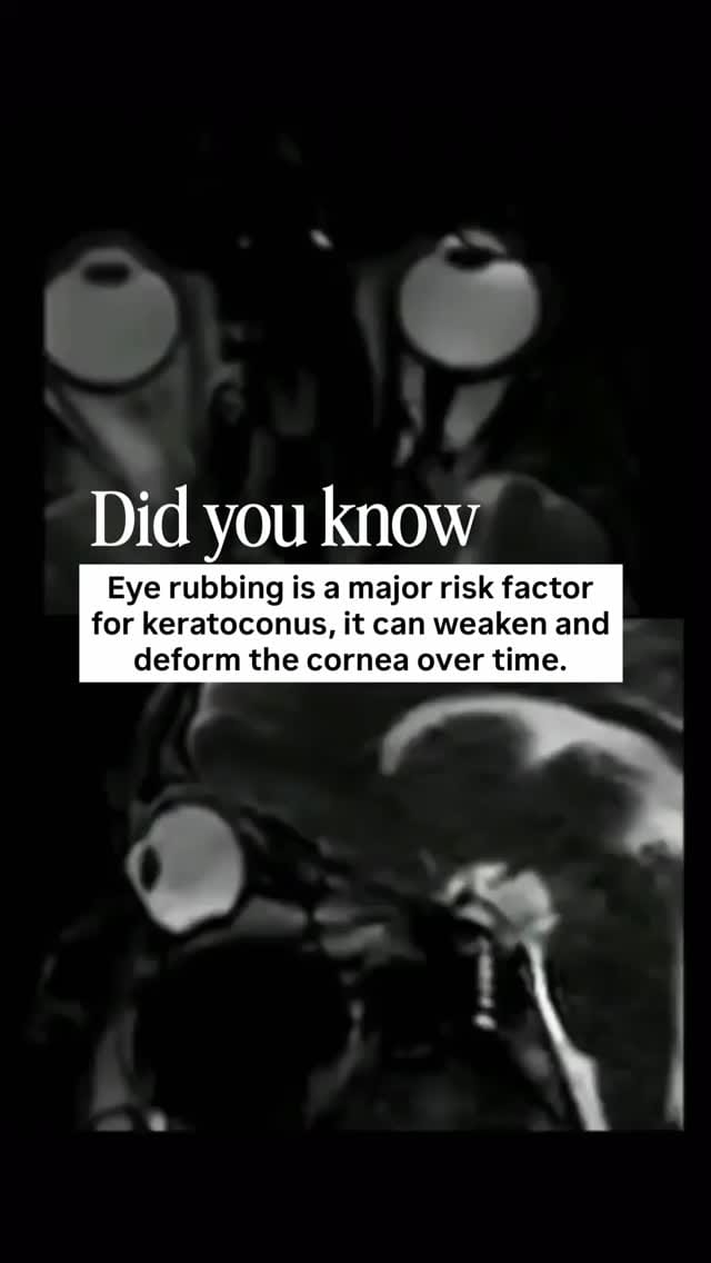 Post 1 by Dr. Elise Kramer, OD on Instagram (video)