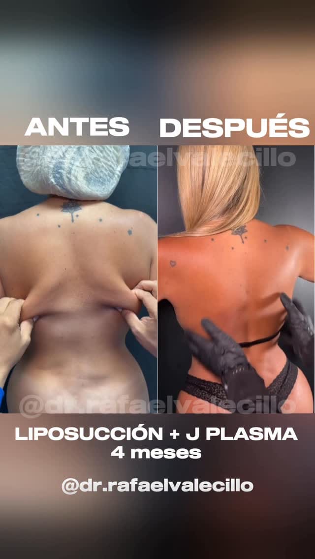 Post 2 by Dr. Rafael Valecillo on Instagram (video)