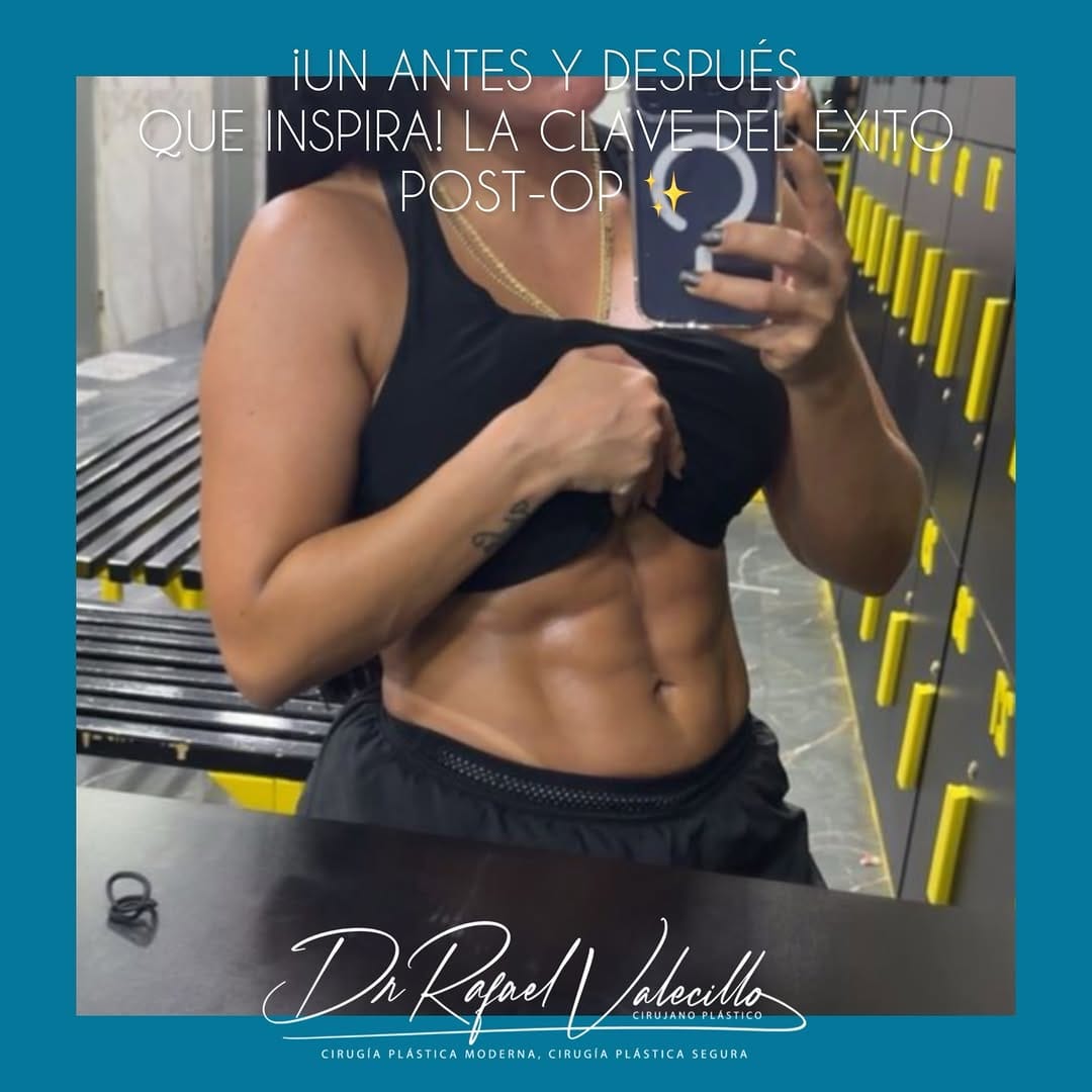 Post 3 by Dr. Rafael Valecillo on Instagram (carousel)
