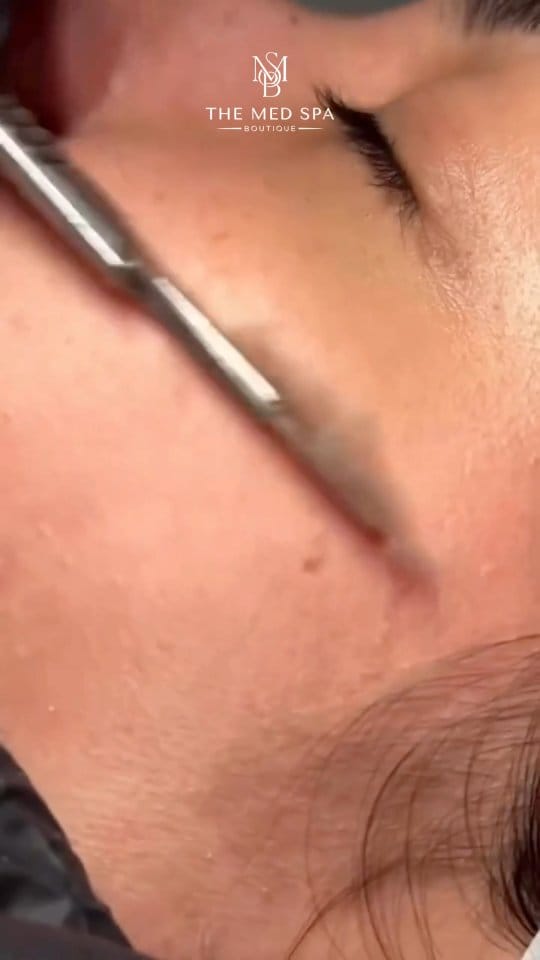 Post 9 by The Med Spa Boutique on Instagram (video)