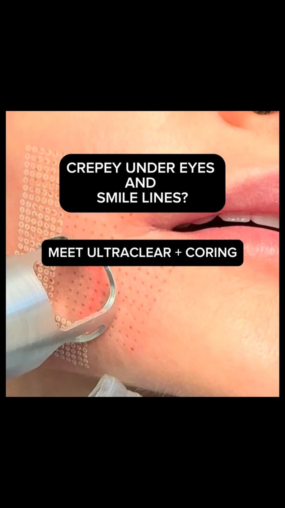 Post 2 by Jordana Herschthal, MD FAAD on Instagram (video)