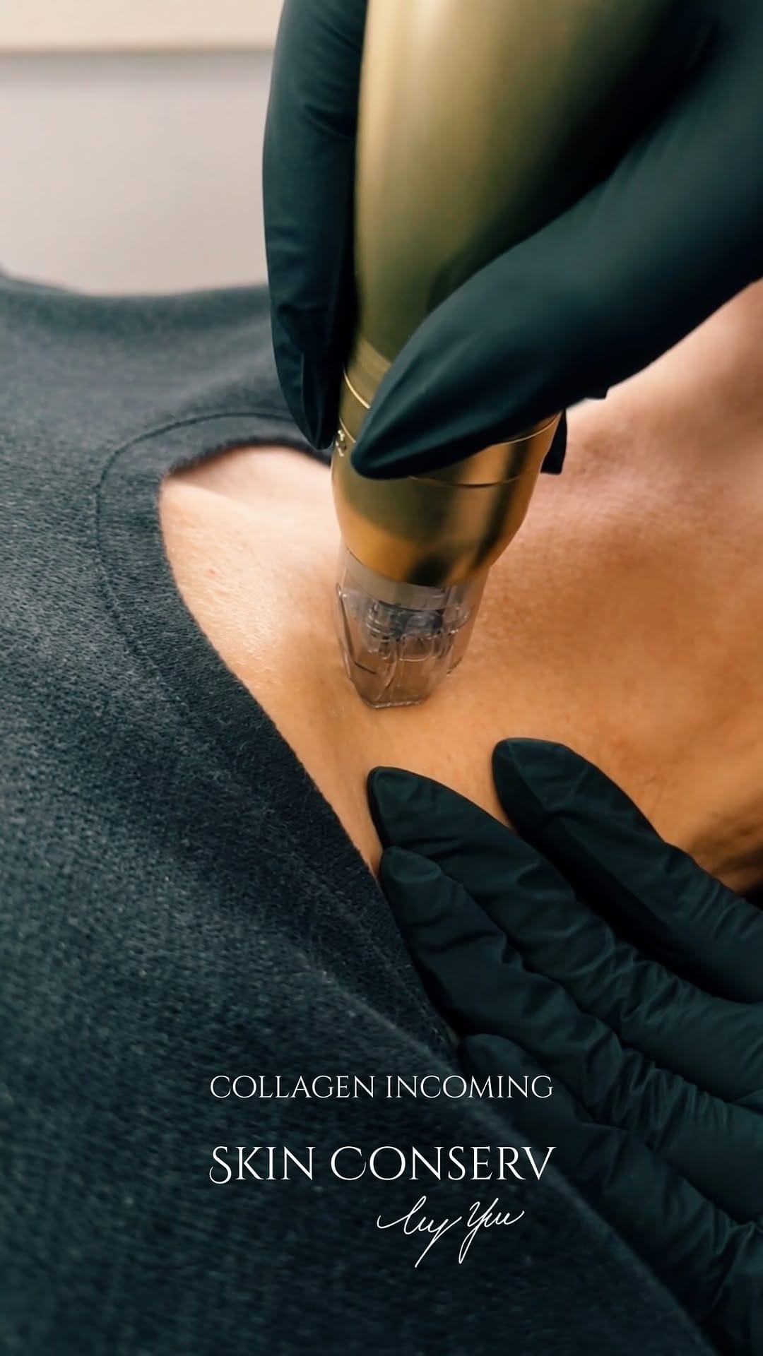 Post 1 by Skin Conserv by Yve on Instagram (video)