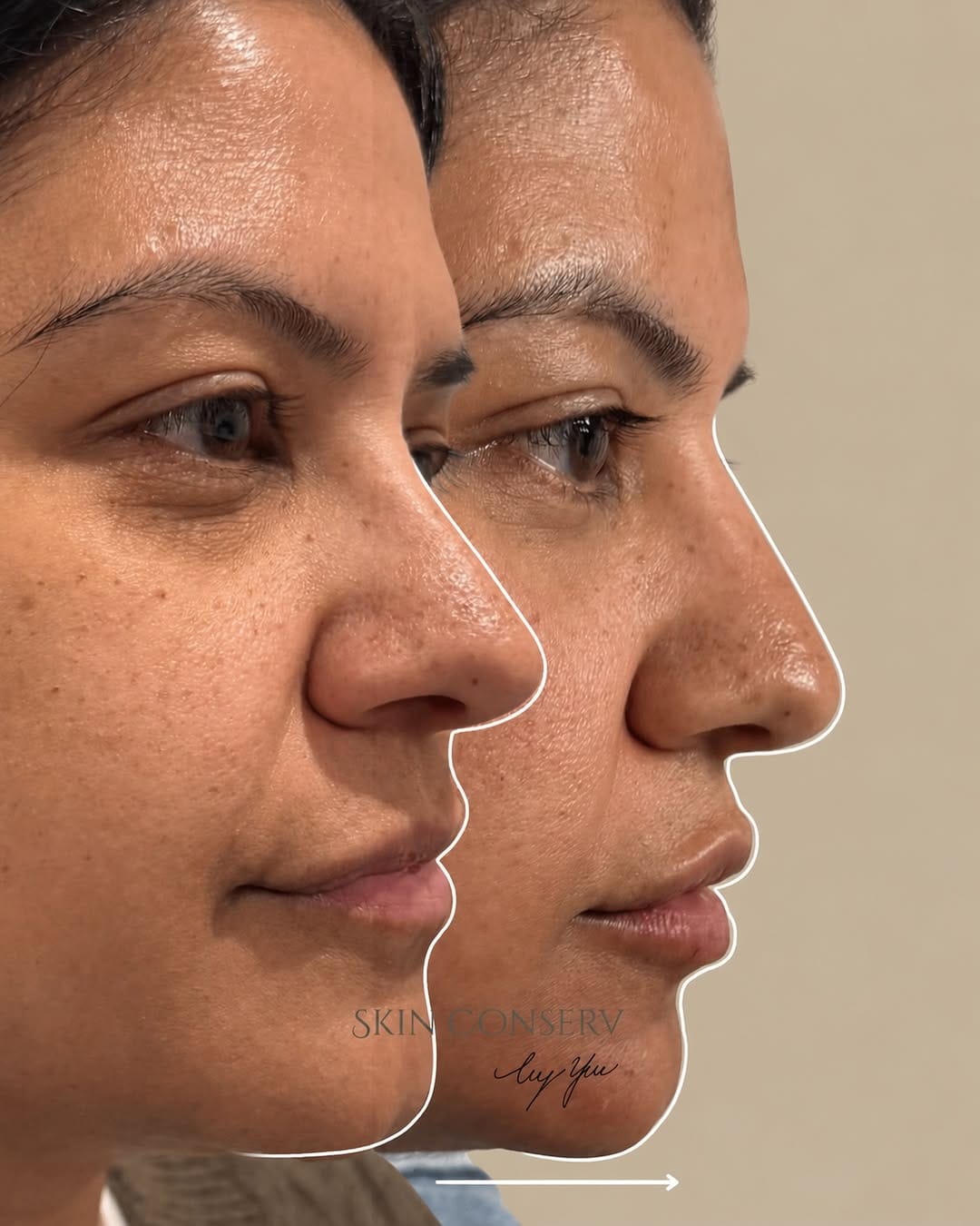 Post 5 by Skin Conserv by Yve on Instagram (image)