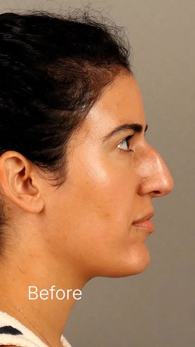 Post 3 by Jon Cabin - DC Plastic Surgeon on Instagram (video)