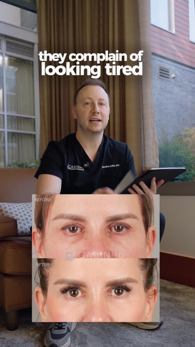 Post 7 by Jon Cabin - DC Plastic Surgeon on Instagram (video)