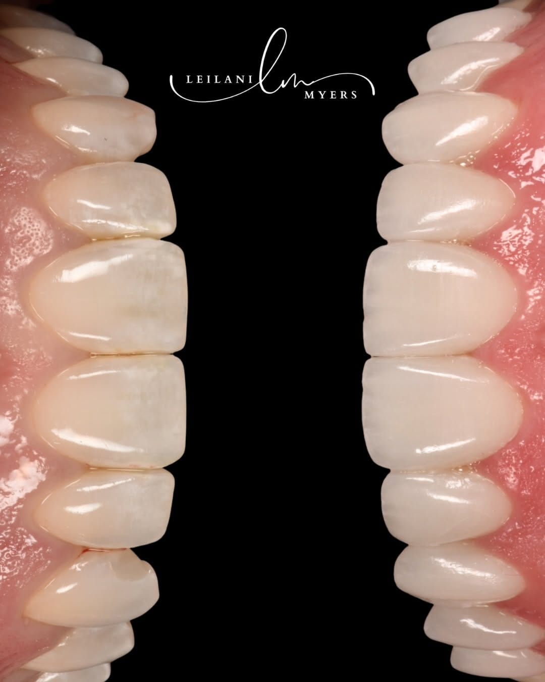 Post 1 by Leilani Myers | Cosmetic Dentist NYC on Instagram (carousel)
