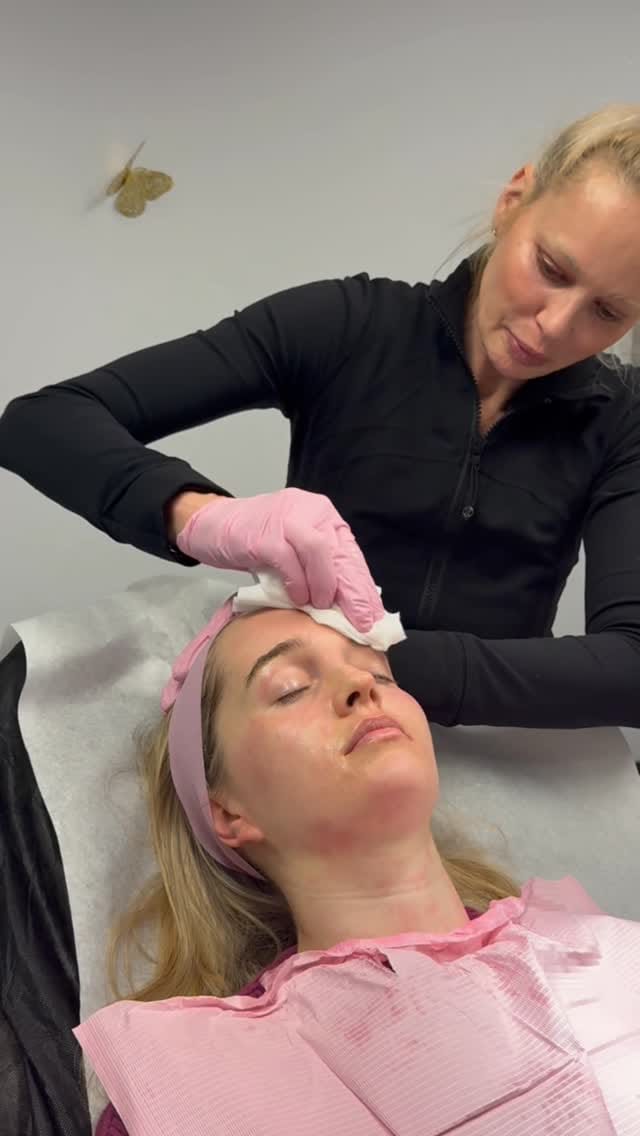 Post 4 by Finesse Cosmetic Surgery on Instagram (video)