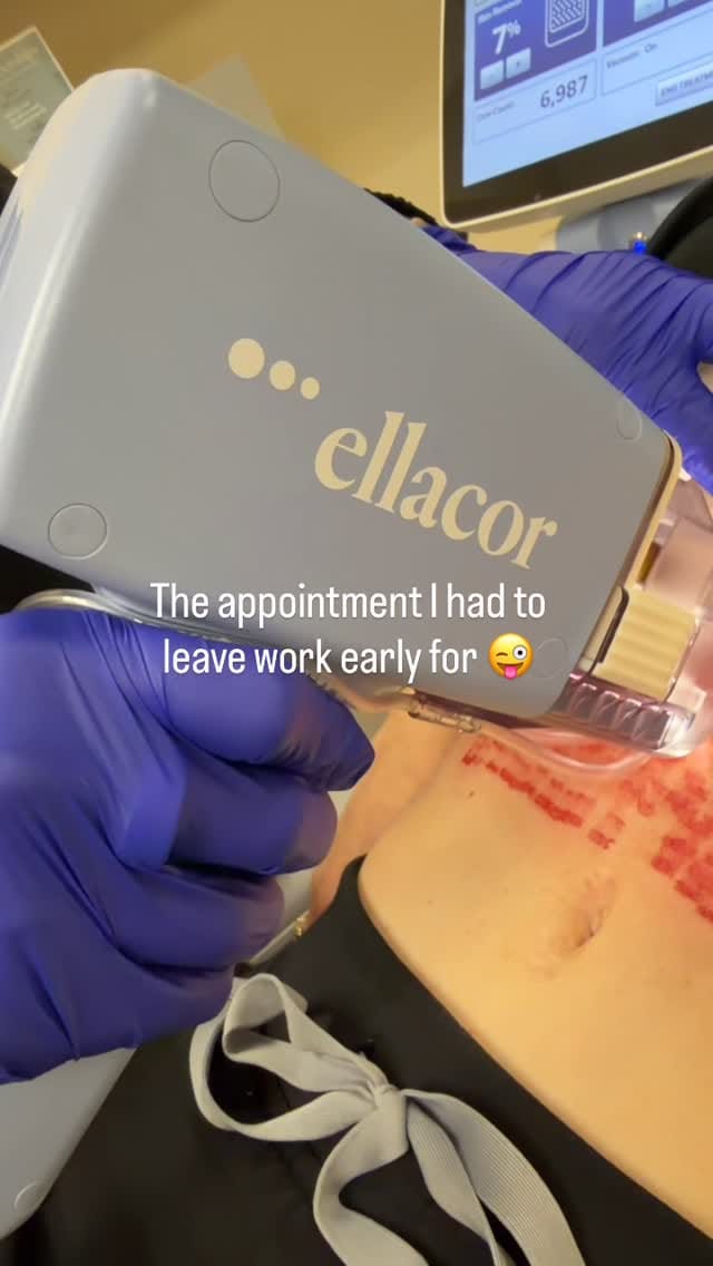 Post 2 by Dr. Ali Totonchi on Instagram (video)
