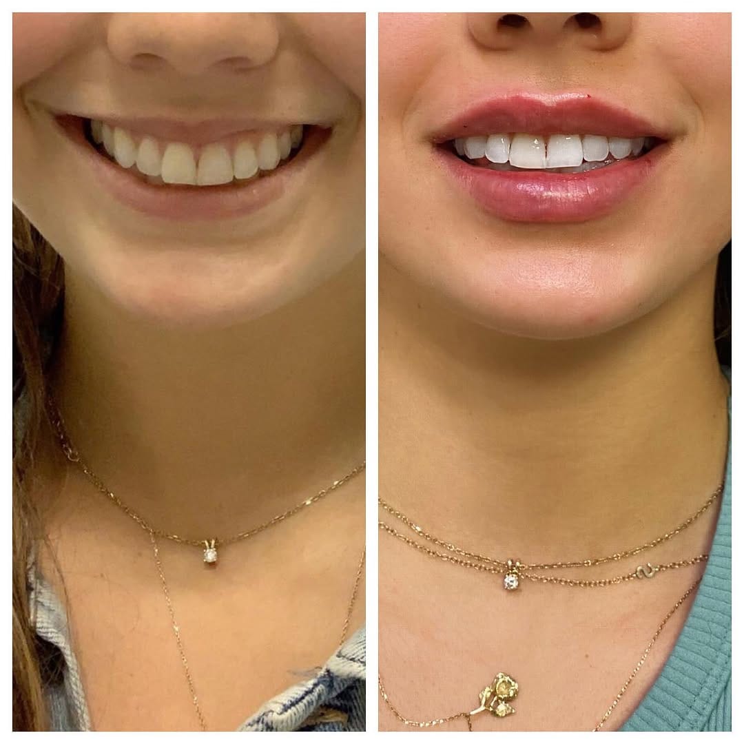 Post 10 by Grace Medical Aesthetics 💉 CT + NY MedSpa on Instagram (image)