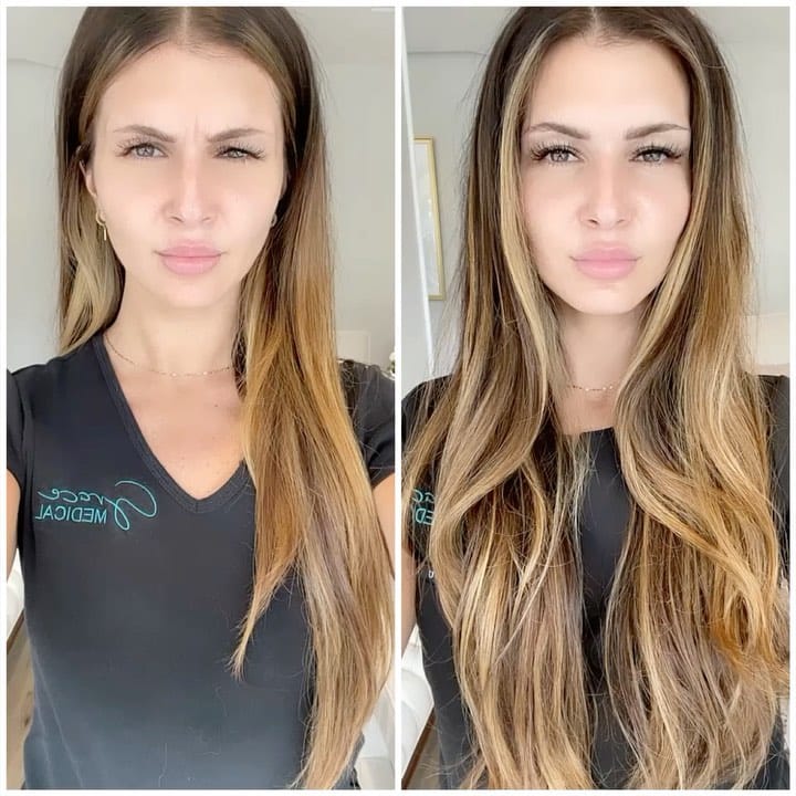 Post 9 by Grace Medical Aesthetics 💉 CT + NY MedSpa on Instagram (video)