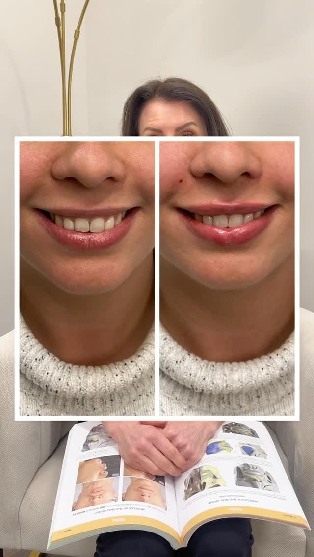 Post 4 by Grace Medical Aesthetics 💉 CT + NY MedSpa on Instagram (video)