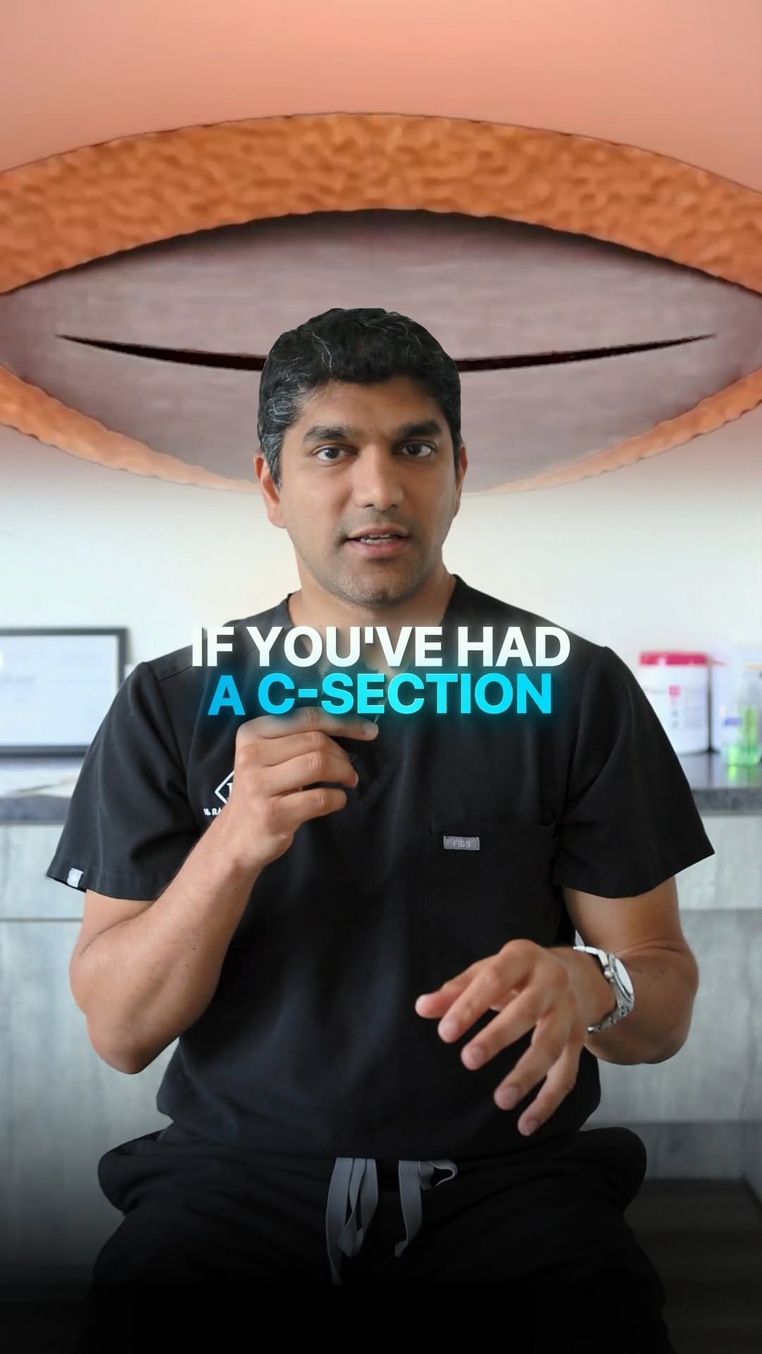 Post 1 by Dr. Raja Mohan | Plastic Surgery on Instagram (video)
