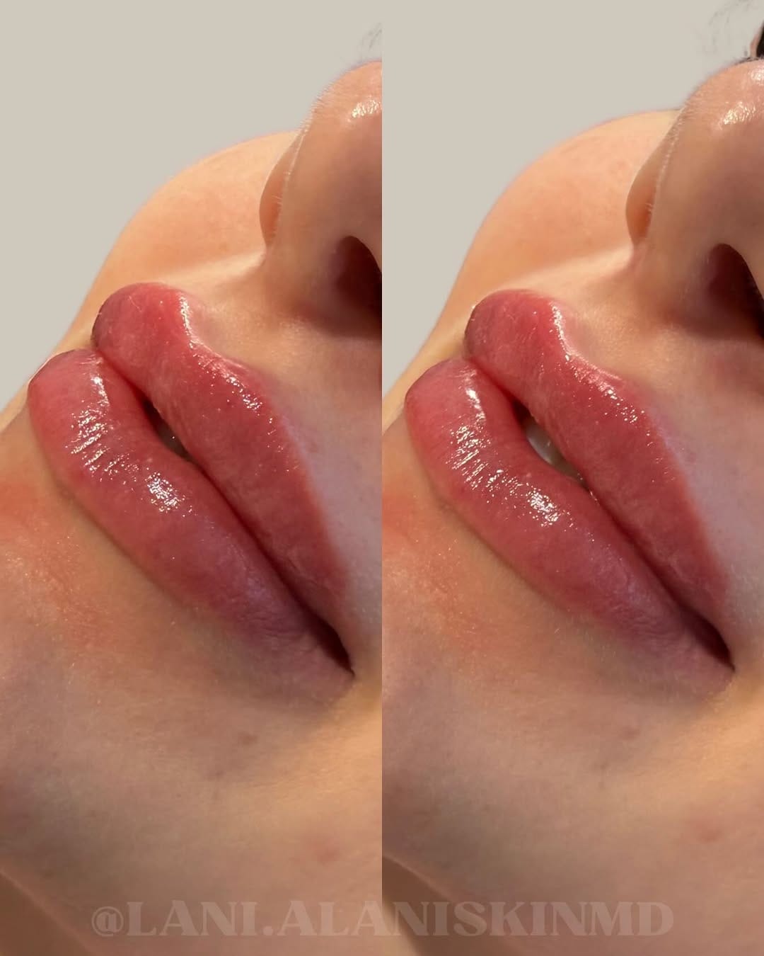Post 8 by Alani Skin MD on Instagram (image)