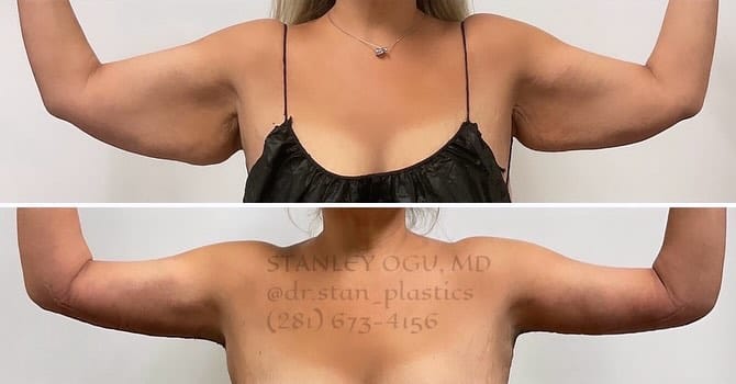 Post 3 by Stanley Ogu, MD FACS on Instagram (carousel)