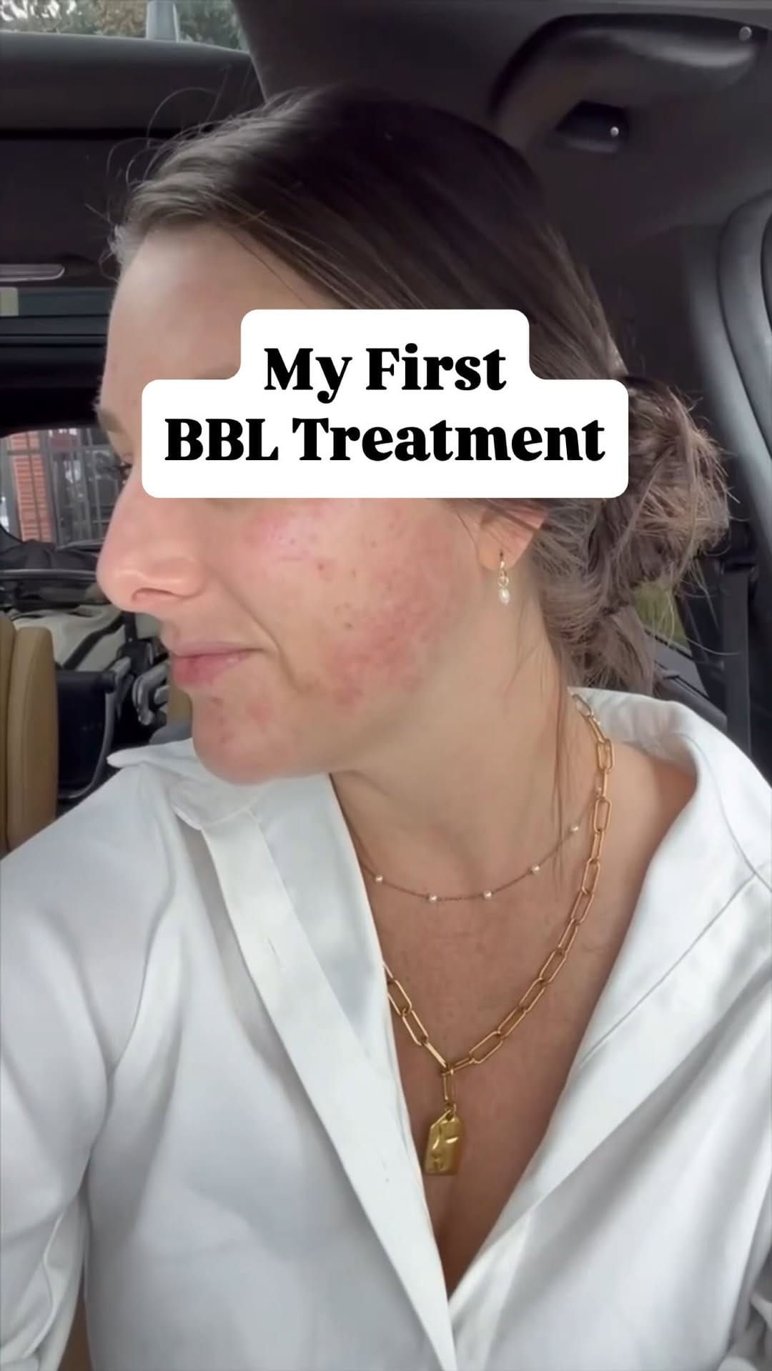 Post 5 by ELLEMES Medical Spa | Atlanta on Instagram (video)
