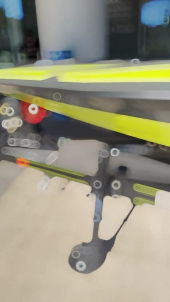 Post 2 by Wolfson Children's Hospital on Instagram (video)
