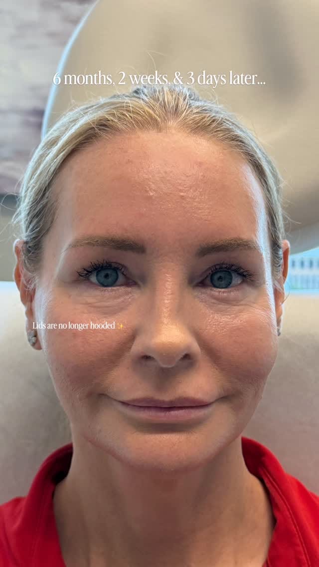 Post 6 by Dr. Sanaz Harirchian | Facial Plastic Surgeon on Instagram (video)