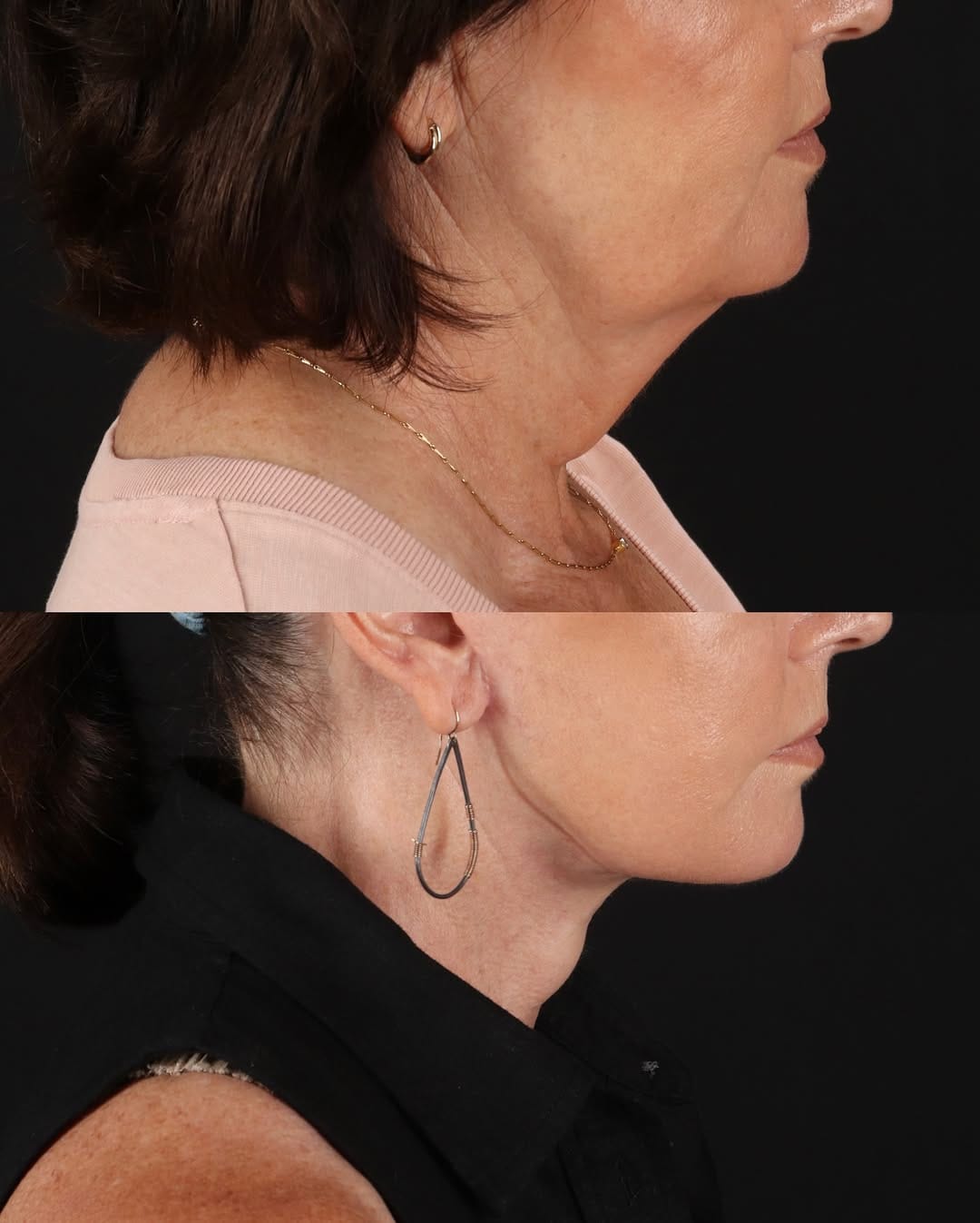 Post 9 by Dr. Sanaz Harirchian | Facial Plastic Surgeon on Instagram (image)
