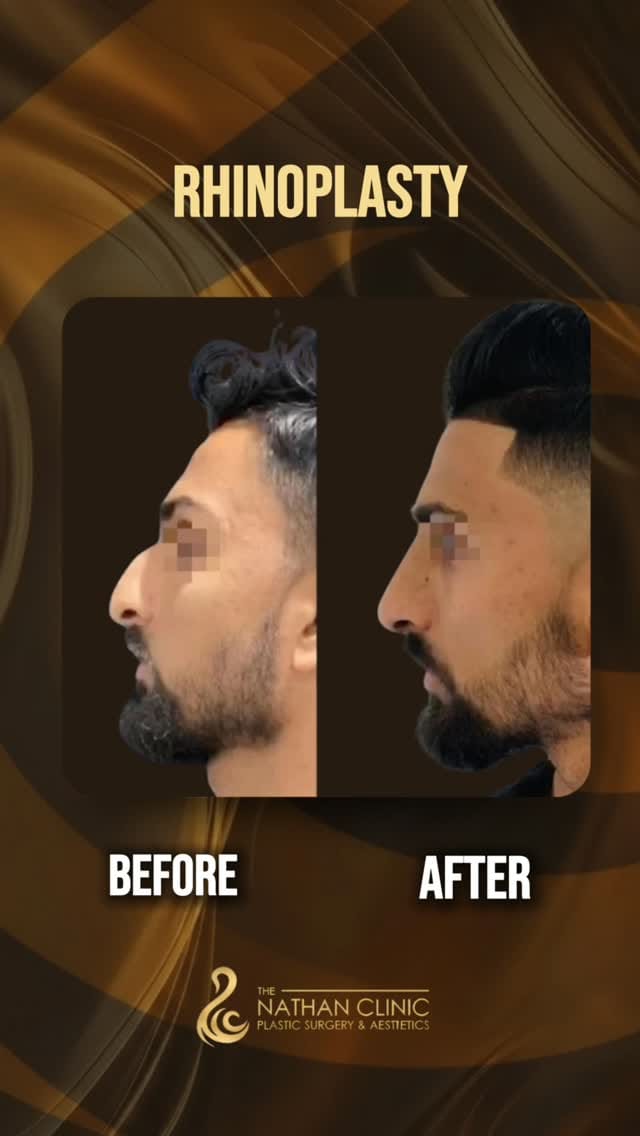 Post 6 by Nirmal R. Nathan, M.D. on Instagram (video)