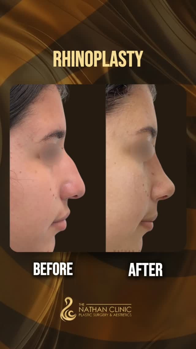 Post 3 by Nirmal R. Nathan, M.D. on Instagram (video)